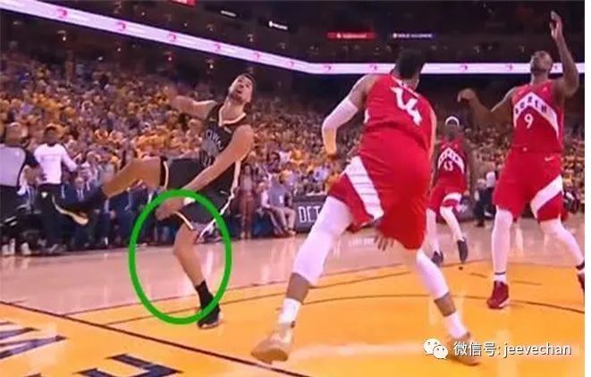 前交叉韧带nba_前交叉韧带损伤原因_膝关节反复扭伤预防