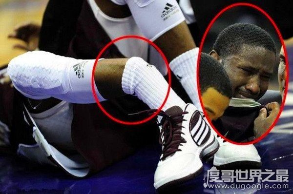NBA最恐怖断腿事件_篮球断腿事故_nba乔治断腿