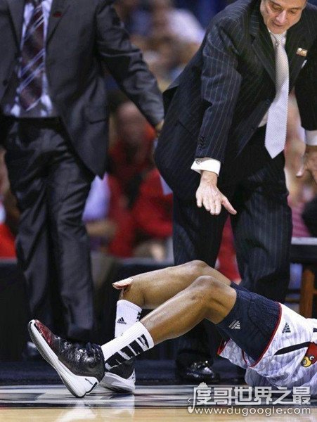 nba乔治断腿_NBA最恐怖断腿事件_篮球断腿事故