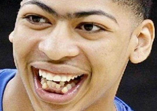 NBA球星长相特点_NBA丑帅球星_最丑的nba球星