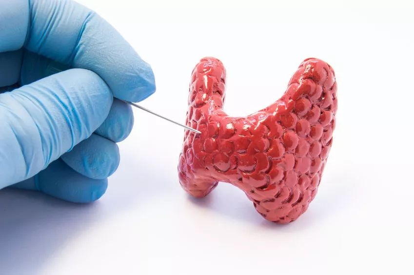 华西甲状腺病研究院_甲状腺癌预防因素_甲状腺癌治疗误区