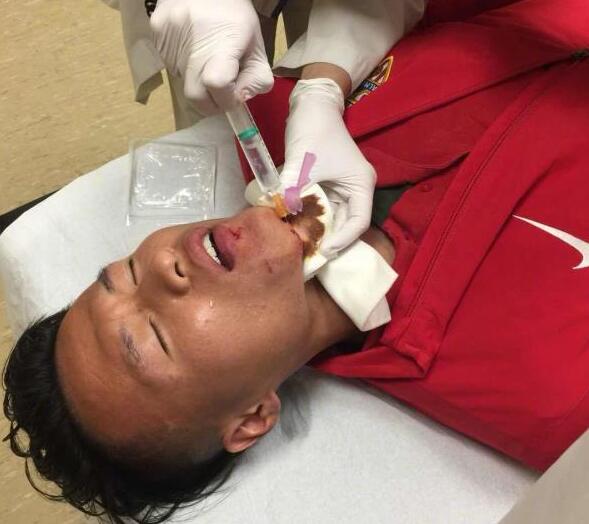 林良铭西甲_林良铭 皇马 阿尔梅里亚