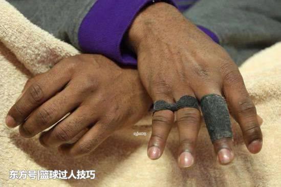 nba球星穿长护膝图_科比护指故事_NBA球员护具原因