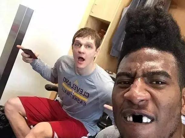 护齿牙套替代品优势_NBA球员嚼泡泡糖历史_nba球员口香糖